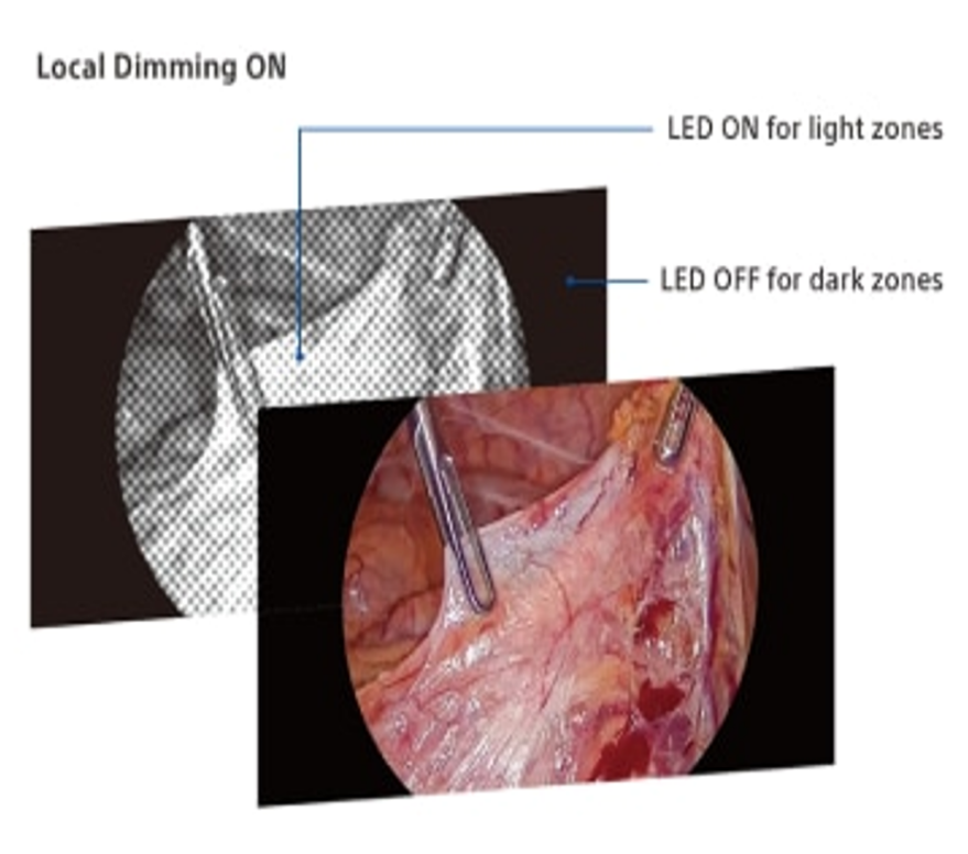Local_Dimming_Technology.png